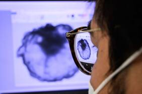 Cáncer en Chile: ¿Cuáles son los que más afectan y en qué regiones son más letales?