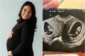 El impactante caso de la mujer que nació con dos úteros y ahora tiene doble embarazo