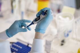 “Hoy no existe vacuna”: Ministro de Ciencia descarta que el ansiado antídoto esté disponible en Chile antes de un año