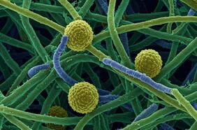 Qué es el Aspergillus, el hongo contagioso que provocó el cierre de pabellones en un hospital en San Bernardo