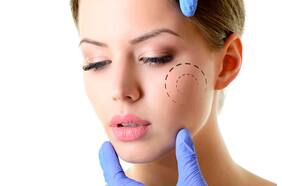 Bichectomía: en qué consiste y cuáles son los riesgos de la cirugía de moda en redes sociales