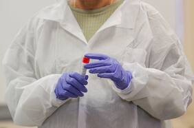 Científicos chilenos desarrollan examen para coronavirus 10 veces más barato y efectivo que el actual