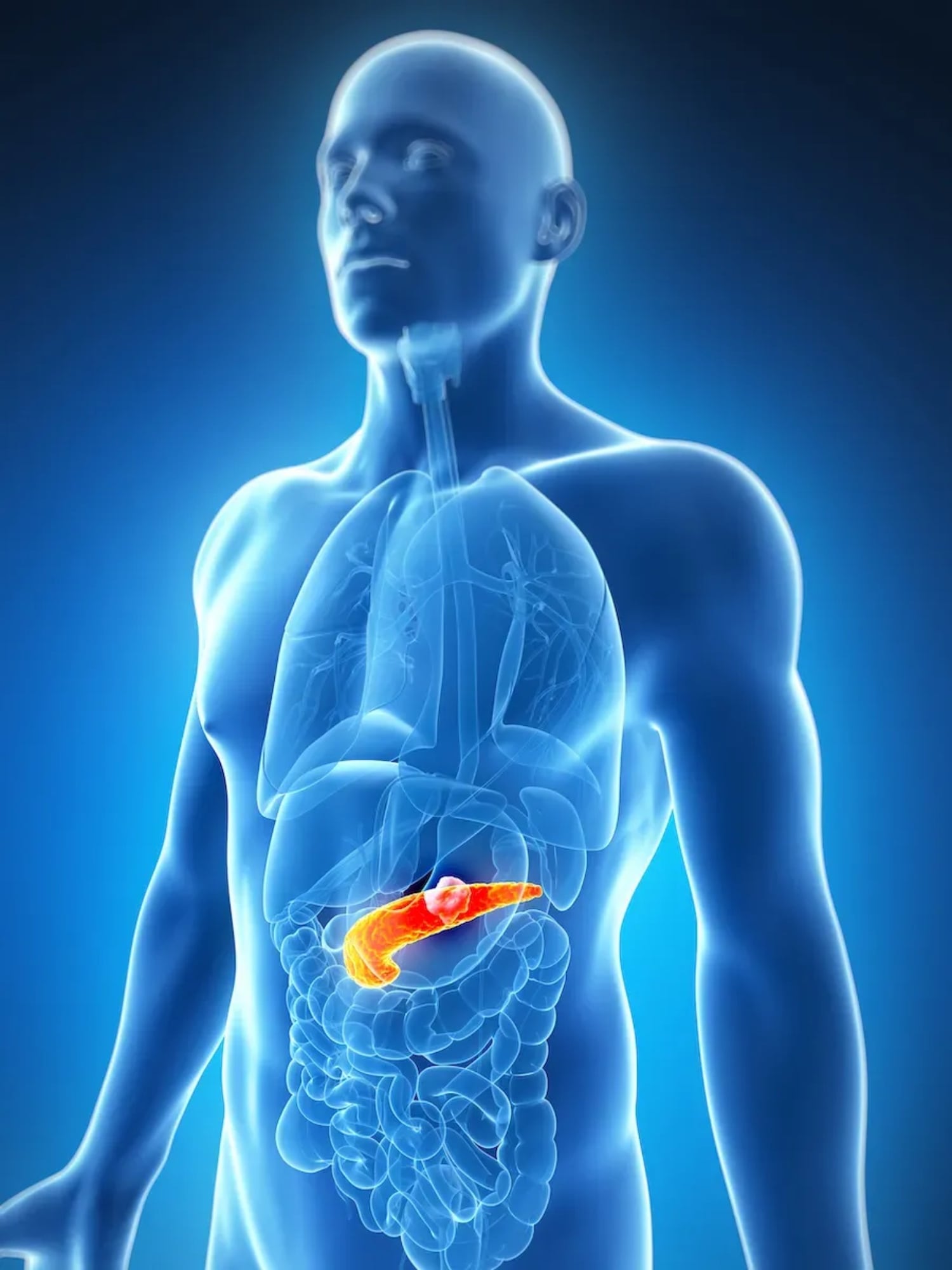 Un ensayo clínico encontró un beneficio inesperado de la vitamina D en el cáncer de páncreas. Foto: referencial.