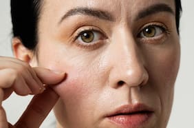 Regenerar la piel desde dentro