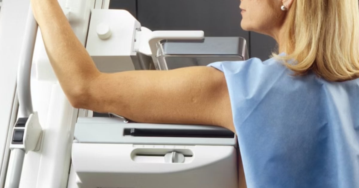 Observatorio del Cáncer revela cifras decidoras: sólo 4 de cada 10 mujeres de 50 a 69 años tienen su mamografía al día
