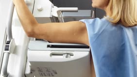 Cáncer de mama: chilenos descubren que el ejercicio de fuerza logra “silenciar” genes asociados a su reaparición