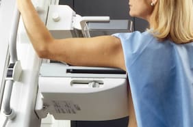 Observatorio del Cáncer revela cifras decidoras: solo 4 de cada 10 mujeres de 50 a 69 años tienen su mamografía al día