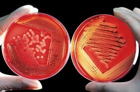 ¿Cómo cambian de forma las células y los tejidos? Científicos chilenos crean un fascinante modelo que predice esta transformación