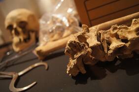 “Quiero donar mi cuerpo a la ciencia”: así funciona la donación de cadáveres en Chile