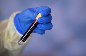 Tu sangre puede decirte si tienes cáncer cuatro años antes de que aparezcan los síntomas