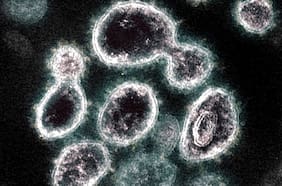 Sólo cuatro casos en el mundo, y uno es chileno: El raro síndrome post Covid-19 que desconcierta a los científicos