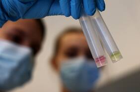 El problema con la tasa de positividad