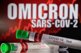 Estos son los cinco principales síntomas de Ómicron; variante prospera en las vías respiratorias, no en los pulmones y Chile es el país mejor preparado del mundo para enfrentarla: tres cosas que aprendimos del coronavirus esta semana