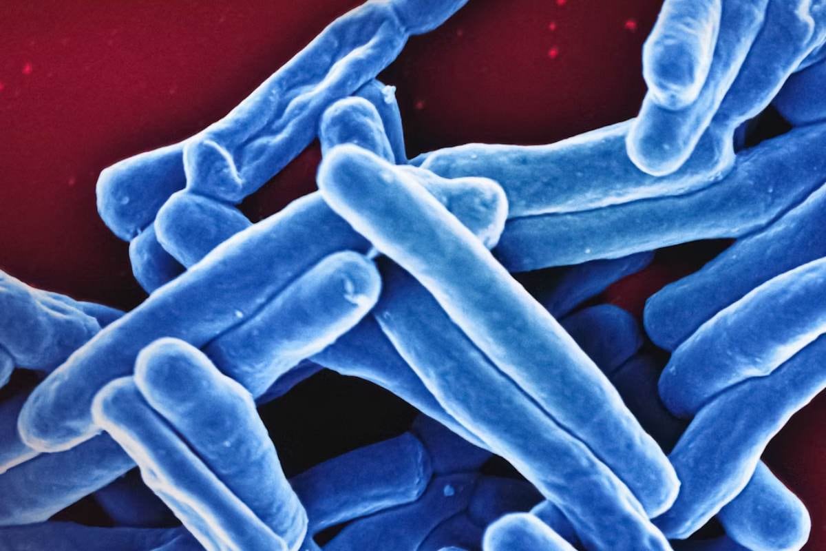 Este probiótico logró eliminar el 43% de los tumores de colon en unas pruebas experimentales