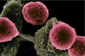 Medicamento contra cáncer ‘enmascarado’ entrena sigilosamente al sistema inmunitario para eliminar tumores