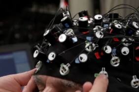 La estimulación eléctrica cerebral podría tratar los trastornos neurodegenerativos