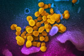 “Ómicron sigiloso”: médicos preocupados por BA.2, la subvariante más contagiosa que ya se ha extendido a 57 países