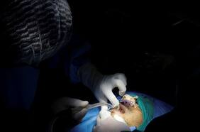 Siguen apareciendo casos de pacientes con hongo negro en Chile: ¿deberíamos preocuparnos?