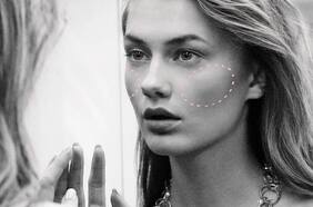 Operación para acentuar pómulos