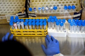 Científicos encuentran coronavirus en semen de pacientes infectados