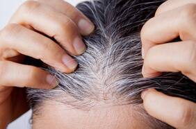 ¿Por qué las canas podrían significar problemas de salud?