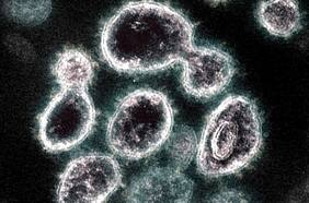 Británica, brasileña, sudafricana: ¿existe también una variante chilena?