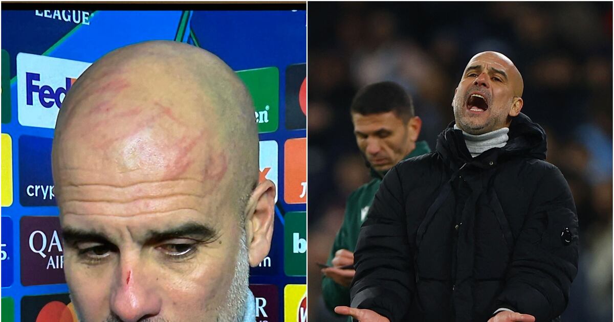Guardiola Con Rasgunos Guardiola sorprende con los rasguños que se realizó en pleno partido ...