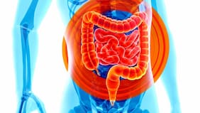 Científicos revelan qué alimentos tienen un compuesto que empeora la inflamación intestinal