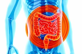 Científicos revelan qué alimentos tienen un compuesto que empeora la inflamación intestinal