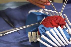 Científicos desarrollan corazones impresos en 3d para reemplazar válvulas cardiacas