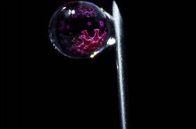 Rafael Araos infectólogo y asesor de Minsal, replica últimas críticas a vacuna de Sinovac: “Tiene una mala publicidad muy injusta”