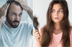 ¿Cómo identificar la caída excesiva de cabello y qué hacer para enfrentarla? Esto dice un experto