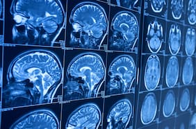 Científicos desarrollan una vacuna contra tumores cerebrales que mostró resultados prometedores en un ensayo clínico