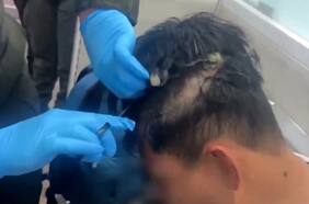Hombre intentó viajar con droga escondida en su peluquín
