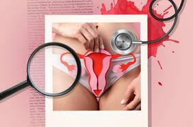 Nuevas luces sobre la endometriosis