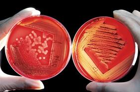 Aumentan muertes por bacteria carnívora y científicos temen que pueda salirse de control