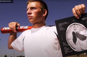 “Una grieta en la armadura”: descubren terapia que mejora supervivencia para tumor cerebral incurable