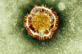 Un mutante: científicos creen que el coronavirus es un híbrido salido de murciélagos y pangolines