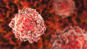 Estudio encuentra una relación entre la vitamina C y una mayor supervivencia en este tipo de cáncer