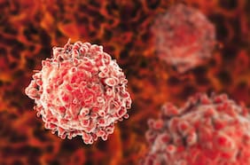 Estudio encuentra una relación entre la vitamina C y una mayor supervivencia en este tipo de cáncer