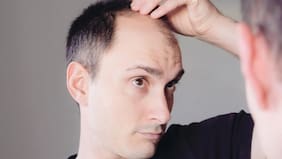 3 razones por las que puedes tener caída de pelo