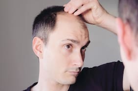 Este es el nuevo efecto secundario de la pérdida de cabello