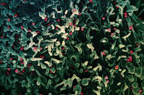 Todo lo que se sabe de la denominada “enfermedad x”, que podría provocar otra pandemia según la OMS