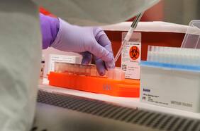 Test de saliva: un problema de paladar