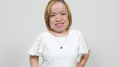 Pediatras, atentos: señales que permiten detectar a tiempo la Mucopolisacaridosis IV A