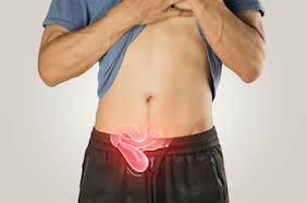 Qué son las hernias inguinales, cuáles son sus síntomas y cuándo es urgente una intervención quirúrgica