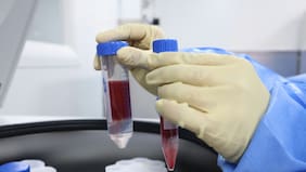 La compleja realidad de las enfermedades hematológicas en Chile