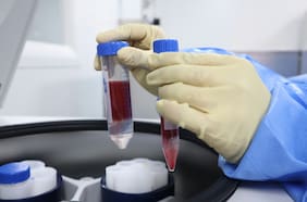 La compleja realidad de las enfermedades hematológicas en Chile