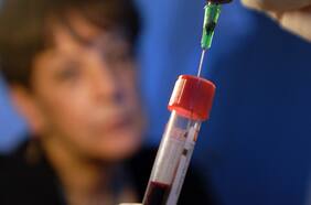 A través de un análisis de sangre: detalles del inédito test para detectar el Alzhéimer