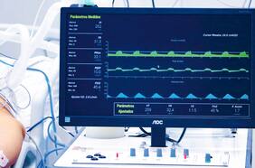 Ventilador chileno diseñado por Asmar y UdeC queda a un paso de iniciar fabricación